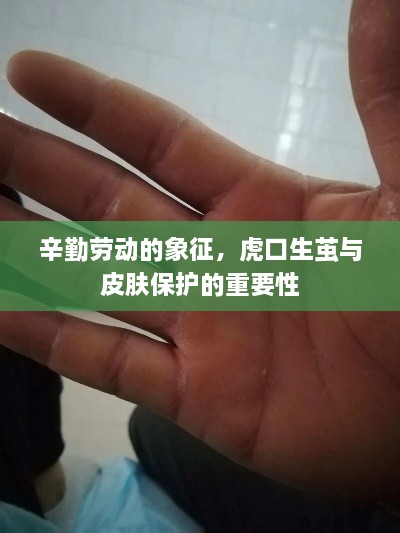 辛勤劳动的象征，虎口生茧与皮肤保护的重要性